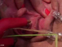 Masajista folla con  ...